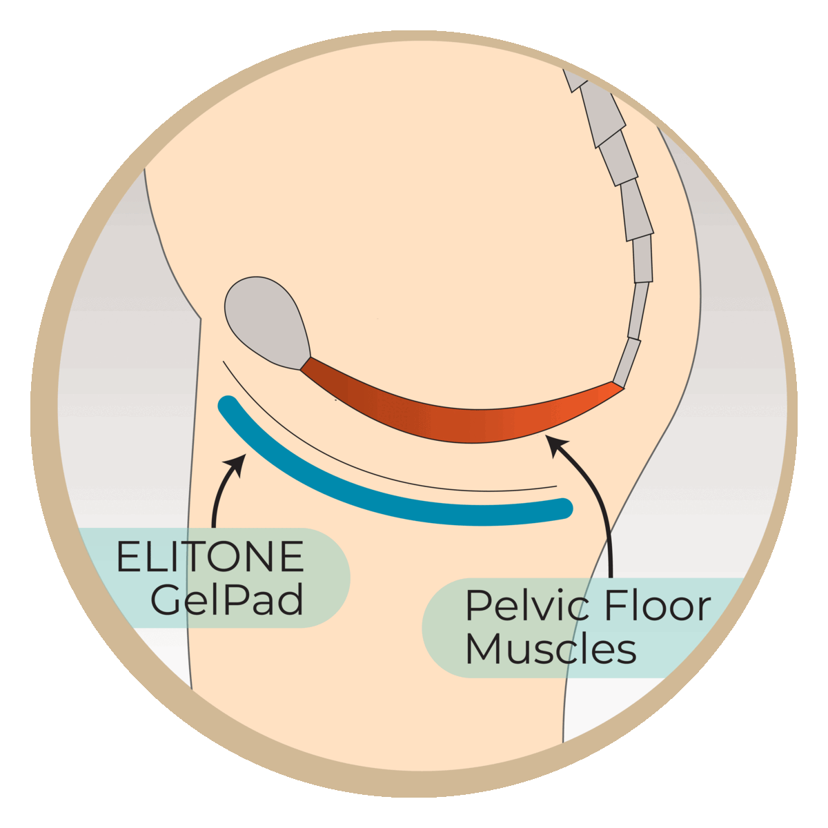 ELITONE is an external Kegel Exerciser to stimulates pelvic floor muscles to reduce urinary leaks